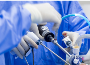 endoscopicaSem título (1).png